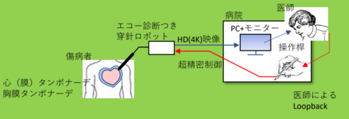 遠隔医療